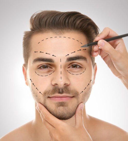 man cosmetic surgery
