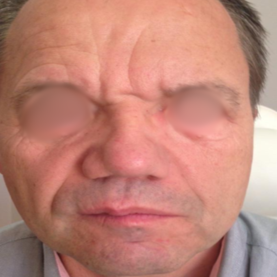 Before & After Gallery 26 Website jirom 13