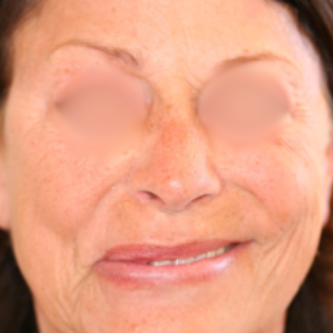 Before & After Gallery 27 Website jirom 16
