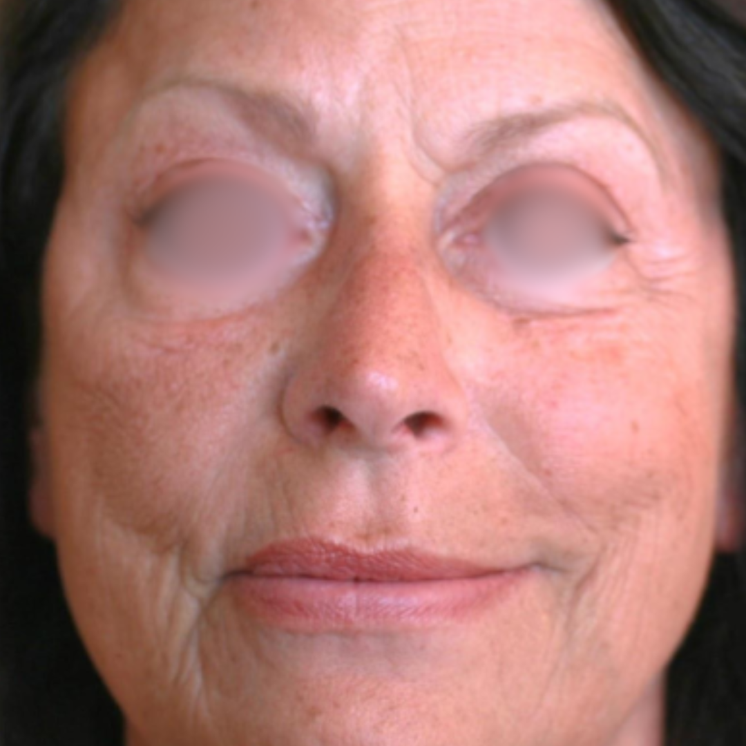 Before & After Gallery 28 Website jirom 17