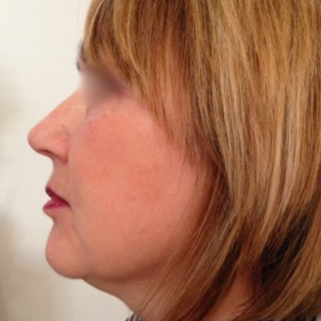 Before & After Gallery 18 Website jirom 3