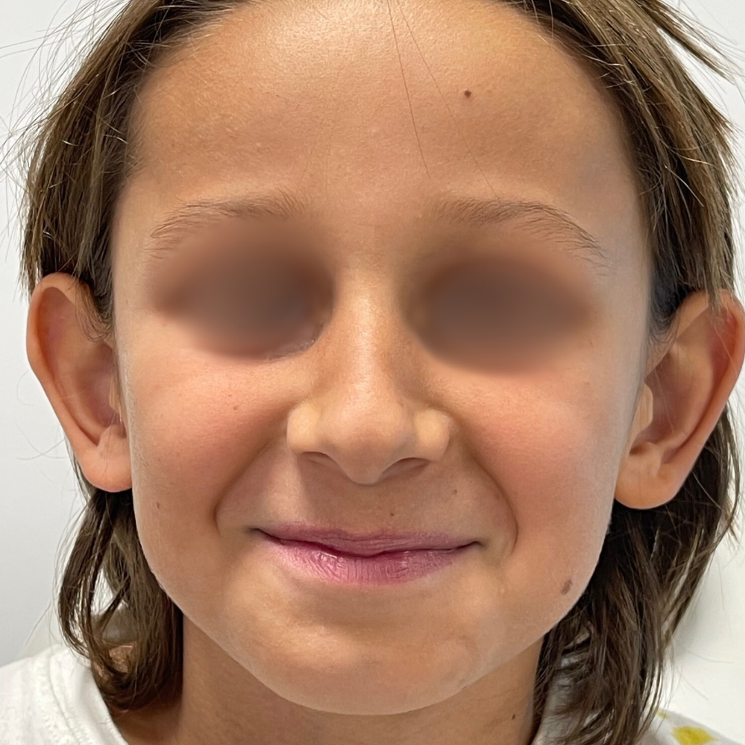 Before & After Gallery 43 Website jirom 46