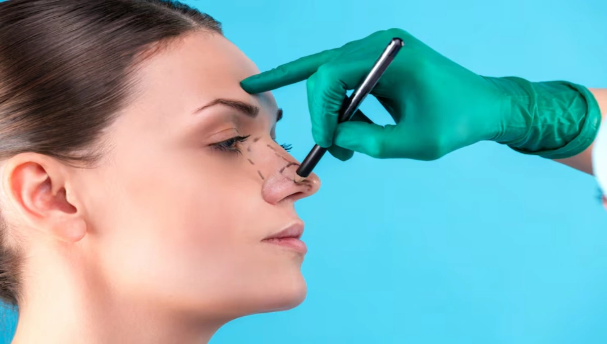 Revision rhinoplasty explained! Discover why some patients in Dubai opt for additional nasal surgery to enhance results and improve function.