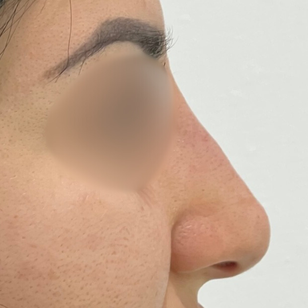 Before & After Gallery 36 Website jirom 13