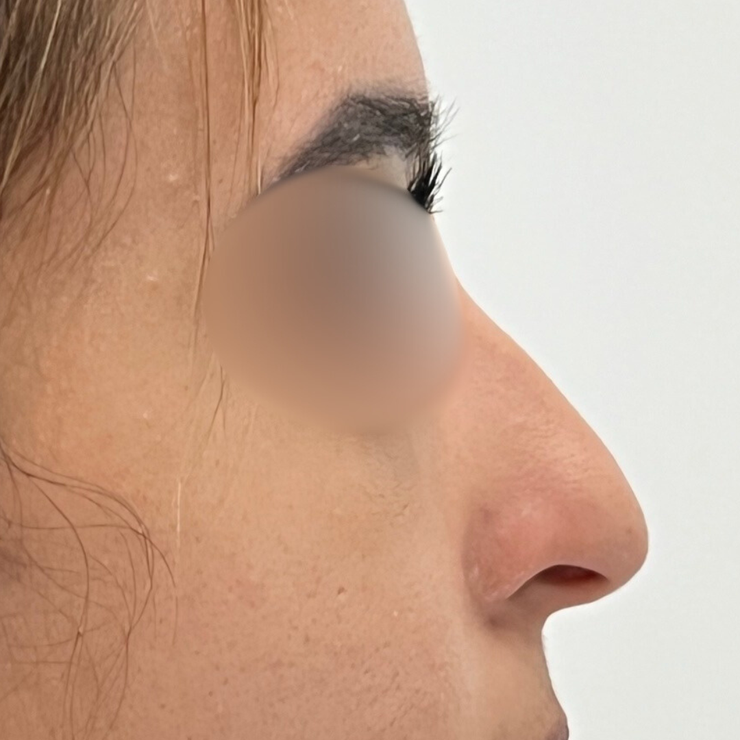 Before & After Gallery 37 Website jirom 2