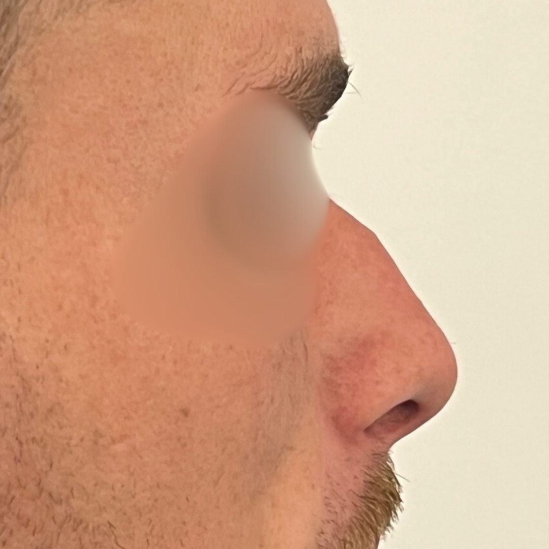 Before & After Gallery 61 Website jirom 30