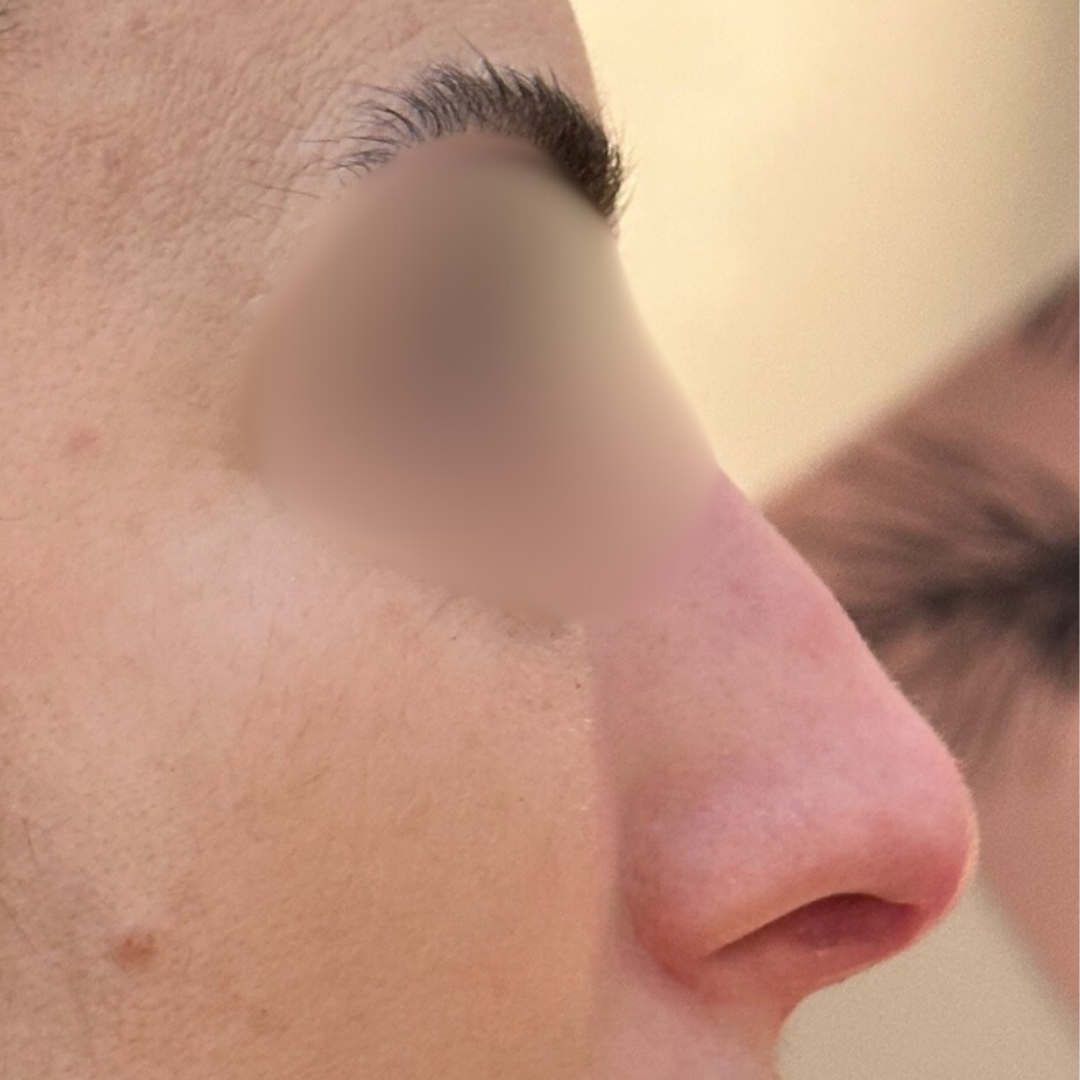 Before & After Gallery 34 Website jirom 9