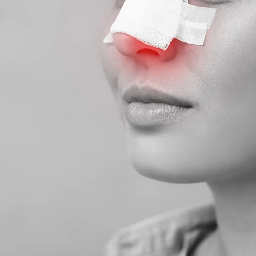 Functional Rhinoplasty: What You Need to Know. Get expert insights on breathing issues and structural nasal repair from Dr. Jerome Paris in Dubai.