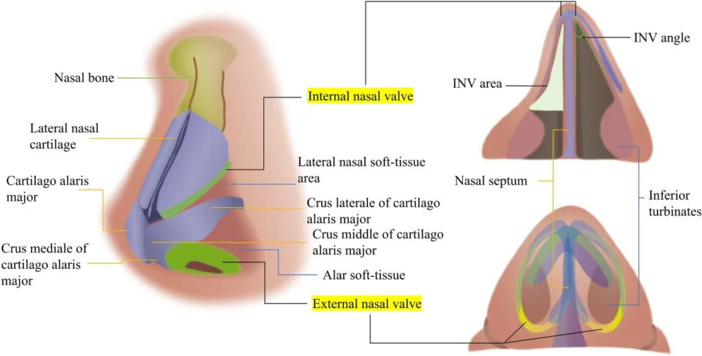 Nasal Valve Repair: Solutions for Breathing Difficulties 1 Don't let a collapsed nasal valve disrupt your life. Explore expert nasal valve repair in Dubai for lasting solutions to breathing difficulties.