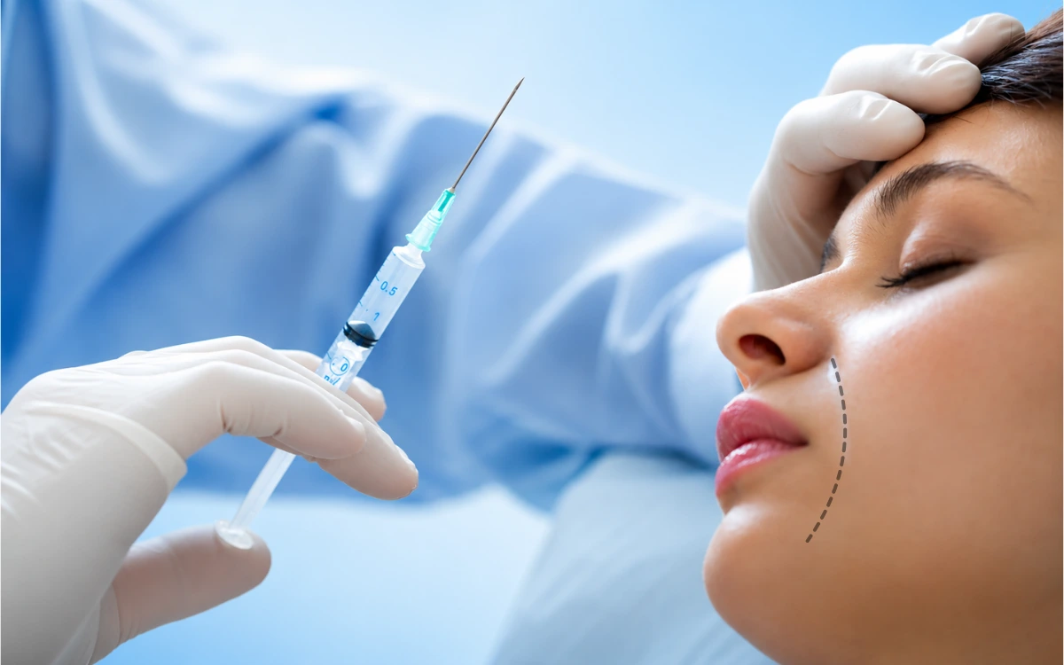 Facial Botox injection treatment targeting wrinkles around the mouth