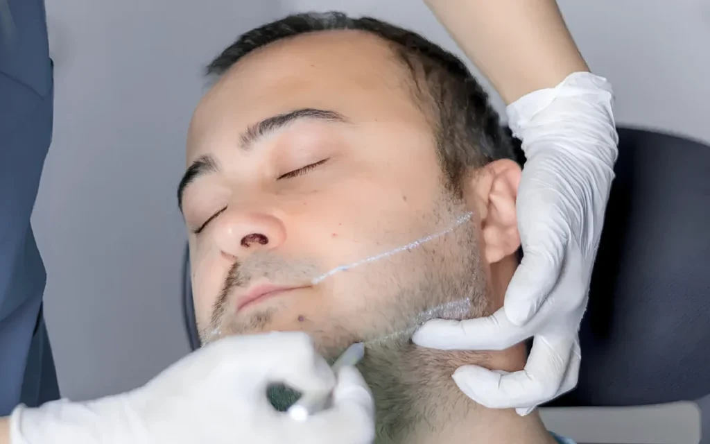 HIFU ultrasound skin tightening treatment in Dubai